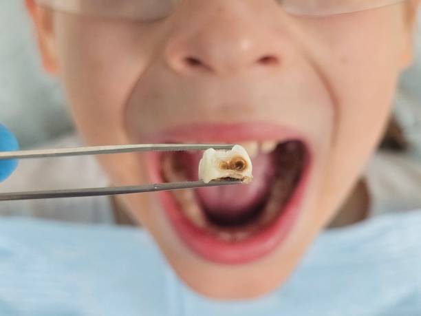 Best Emergency Dental Services for Seniors in Patterson Tract, CA